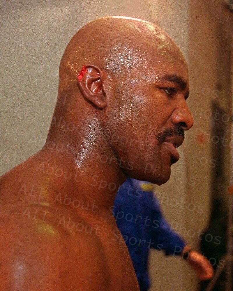 boxing ear incident