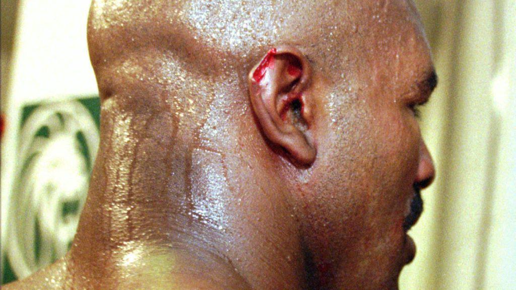 boxing ear injury