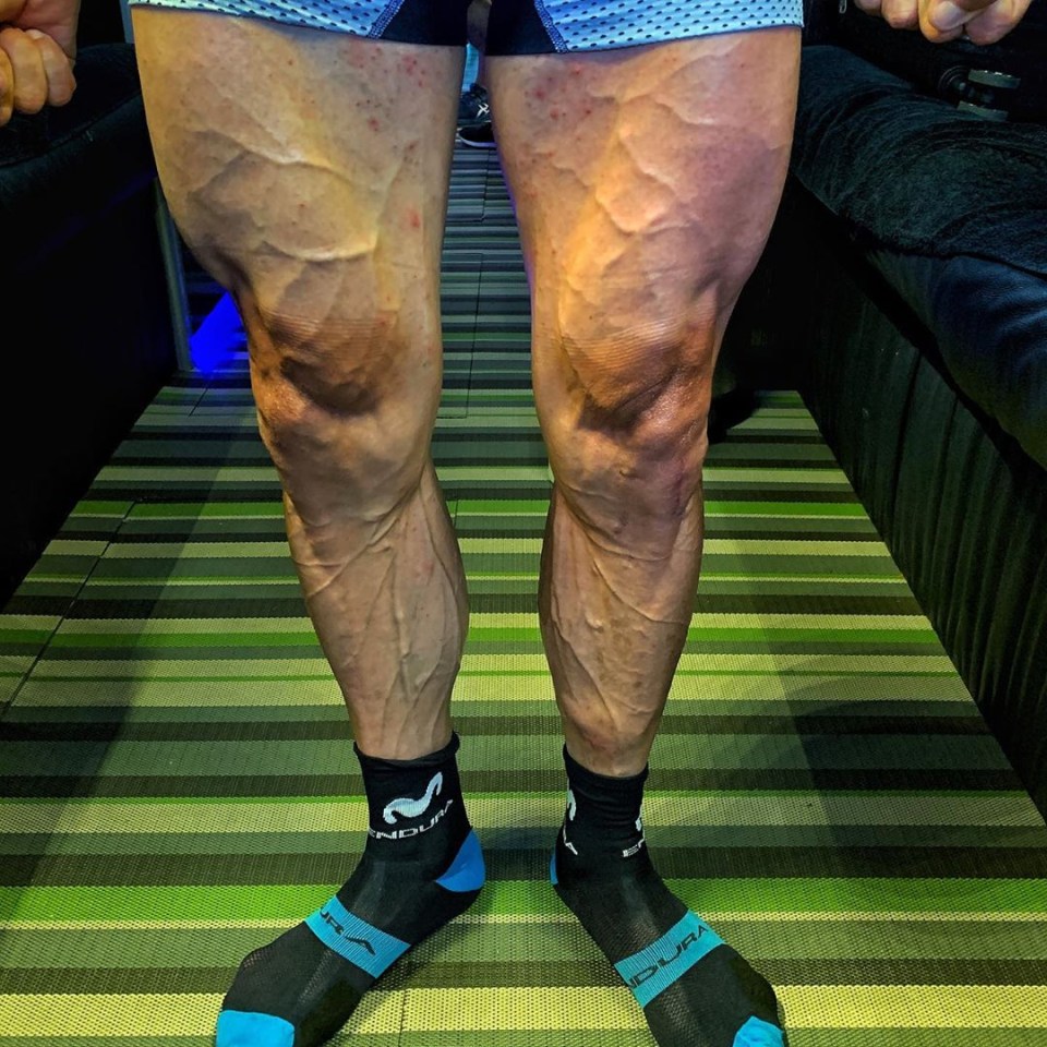 chris froome legs 0018