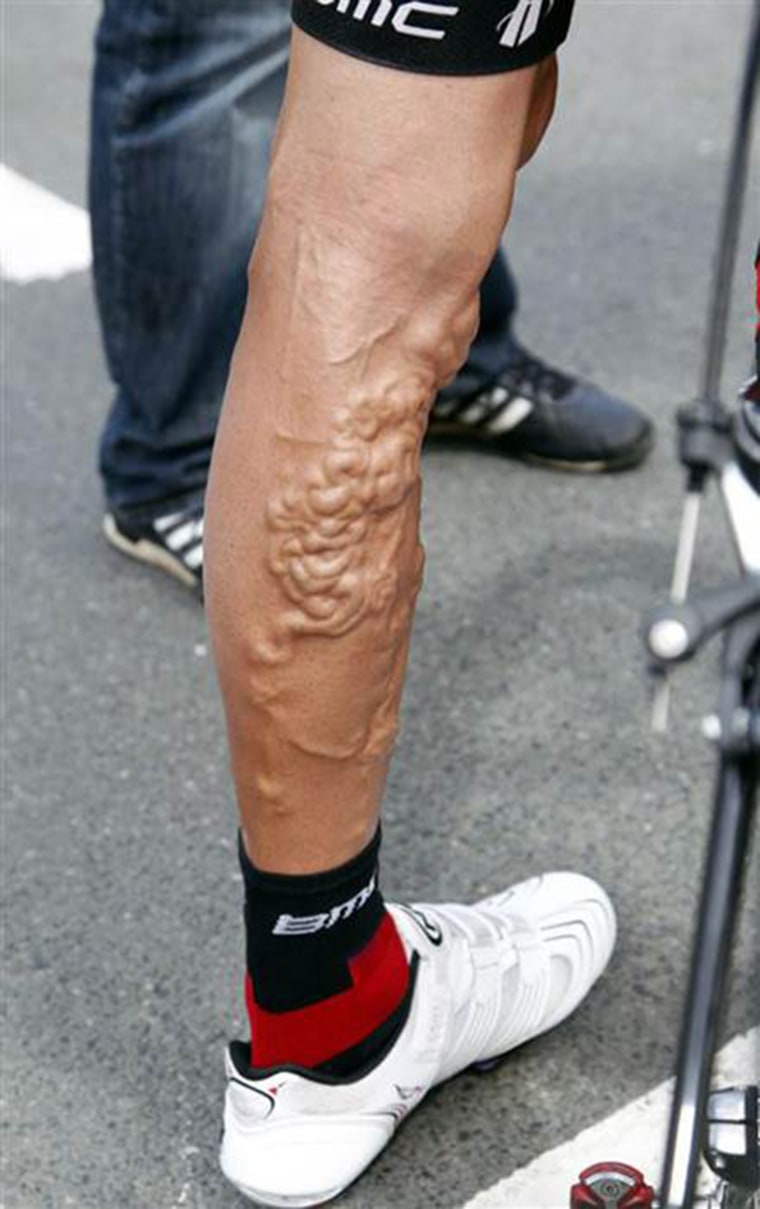 chris froome legs 0021