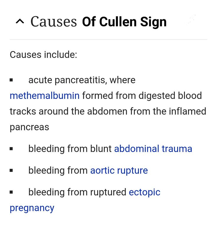 cullen sign photos 0010