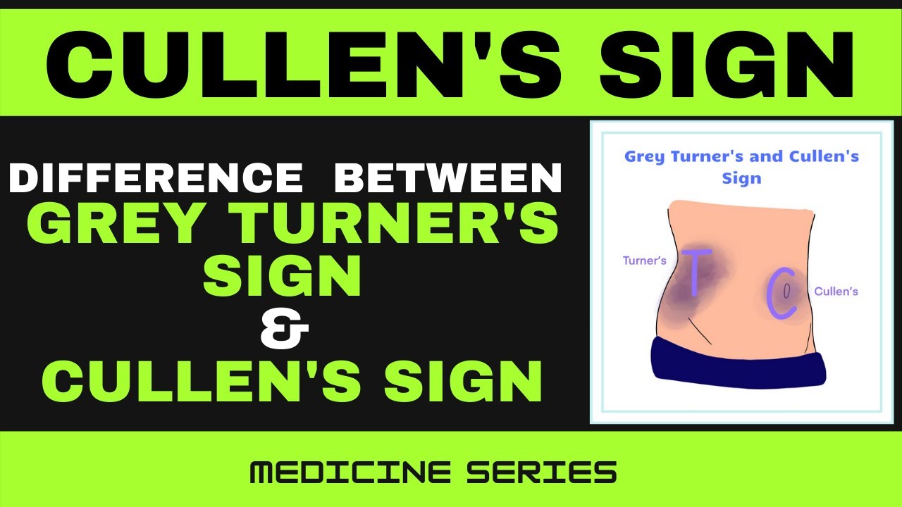 cullen sign photos 0011