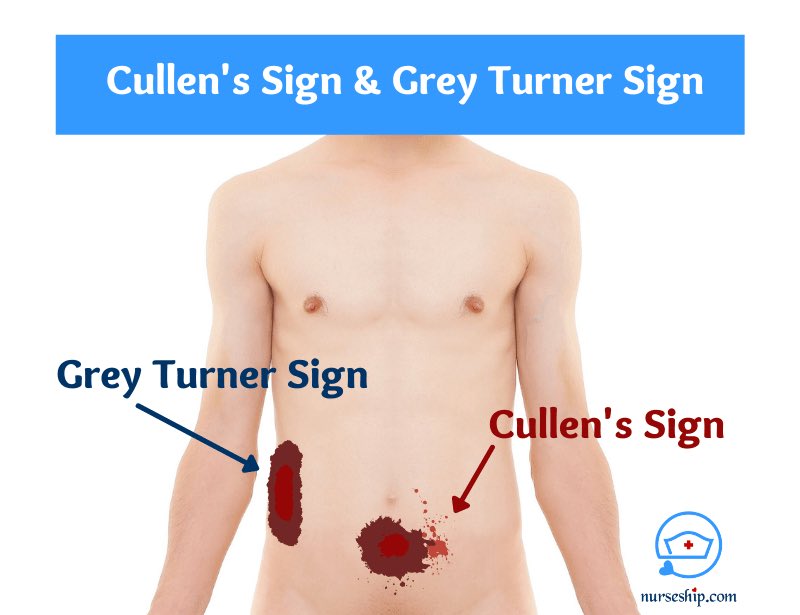 cullen sign photos 0026