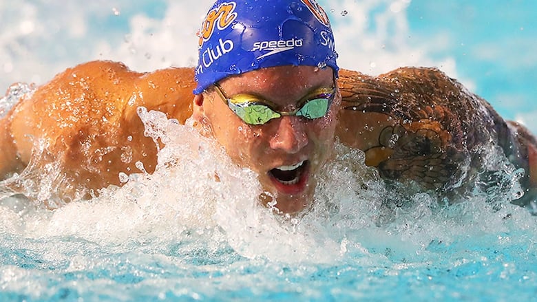 Dressel butterfly technique