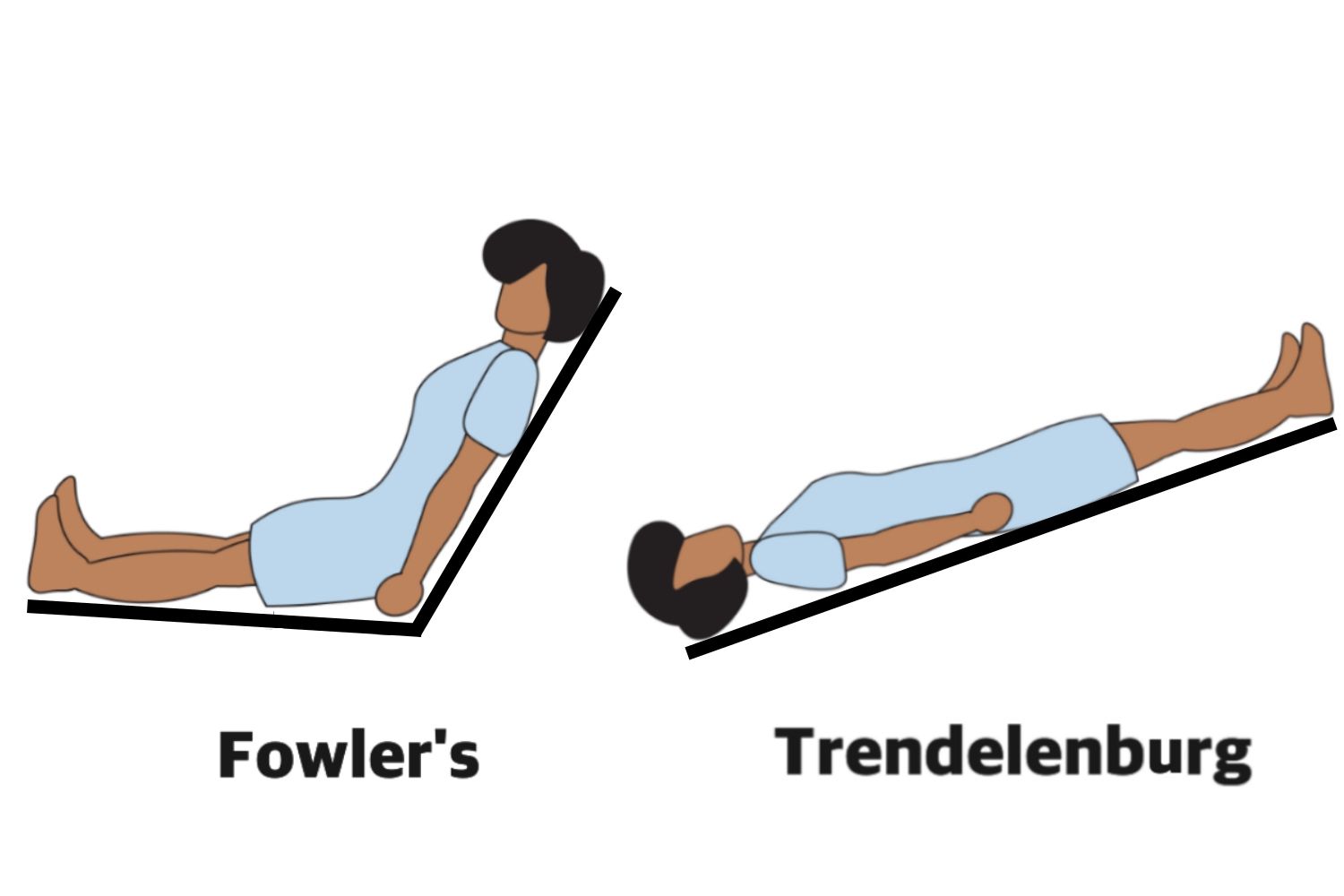 high fowler position images 0041