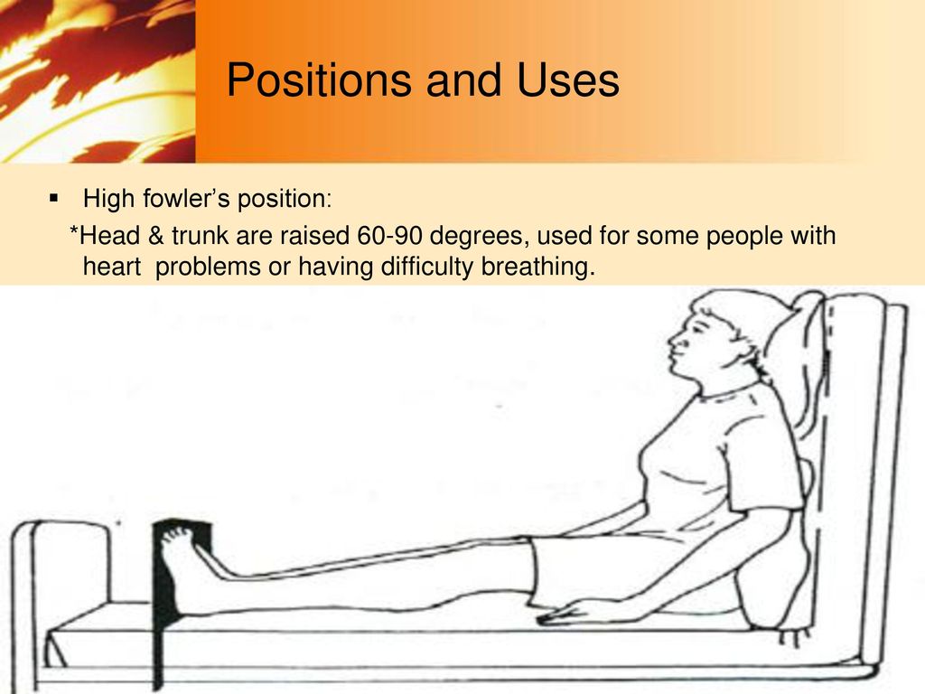 high fowler position images 0045