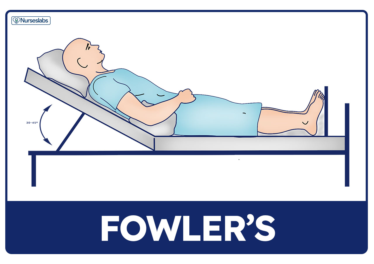 high fowler position nursing