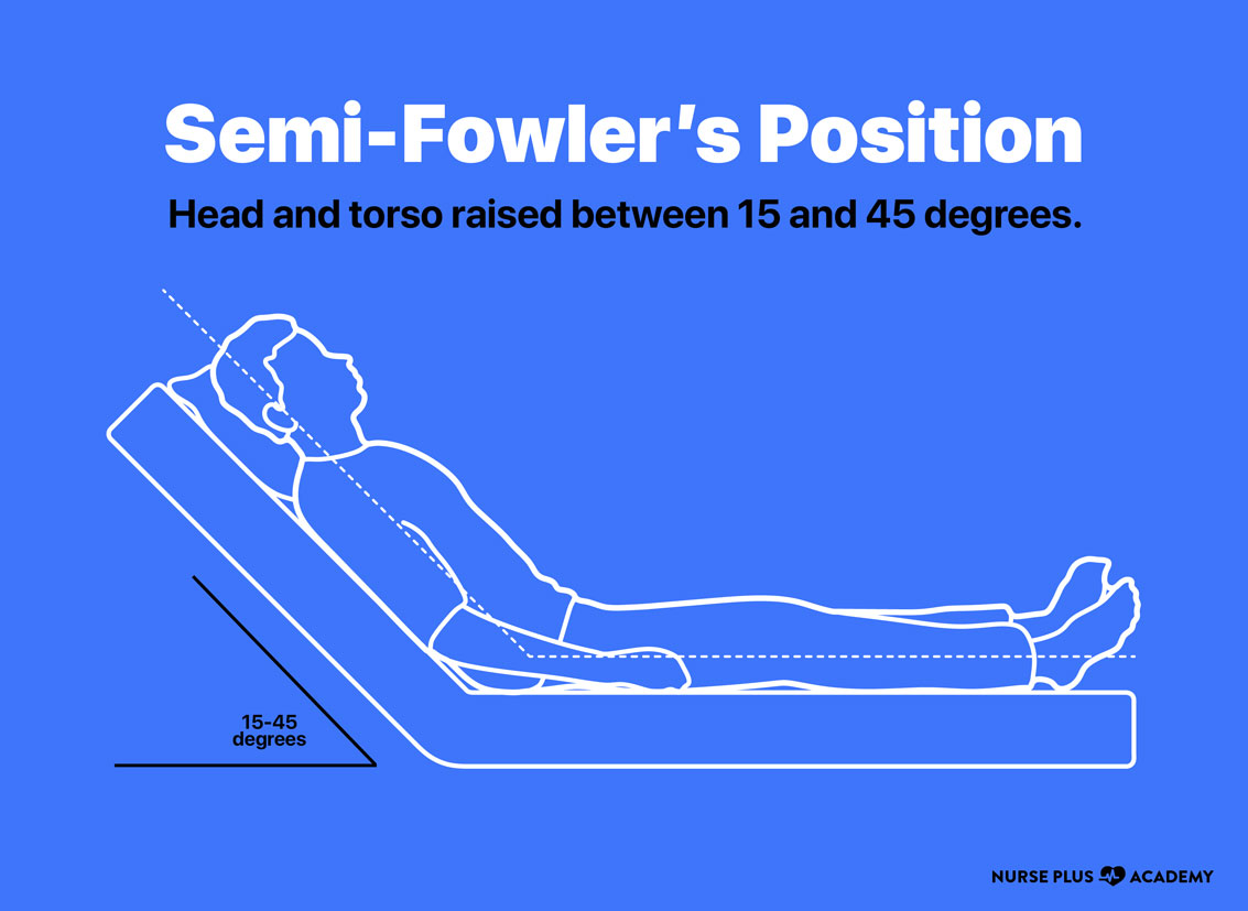 high fowler position techniques