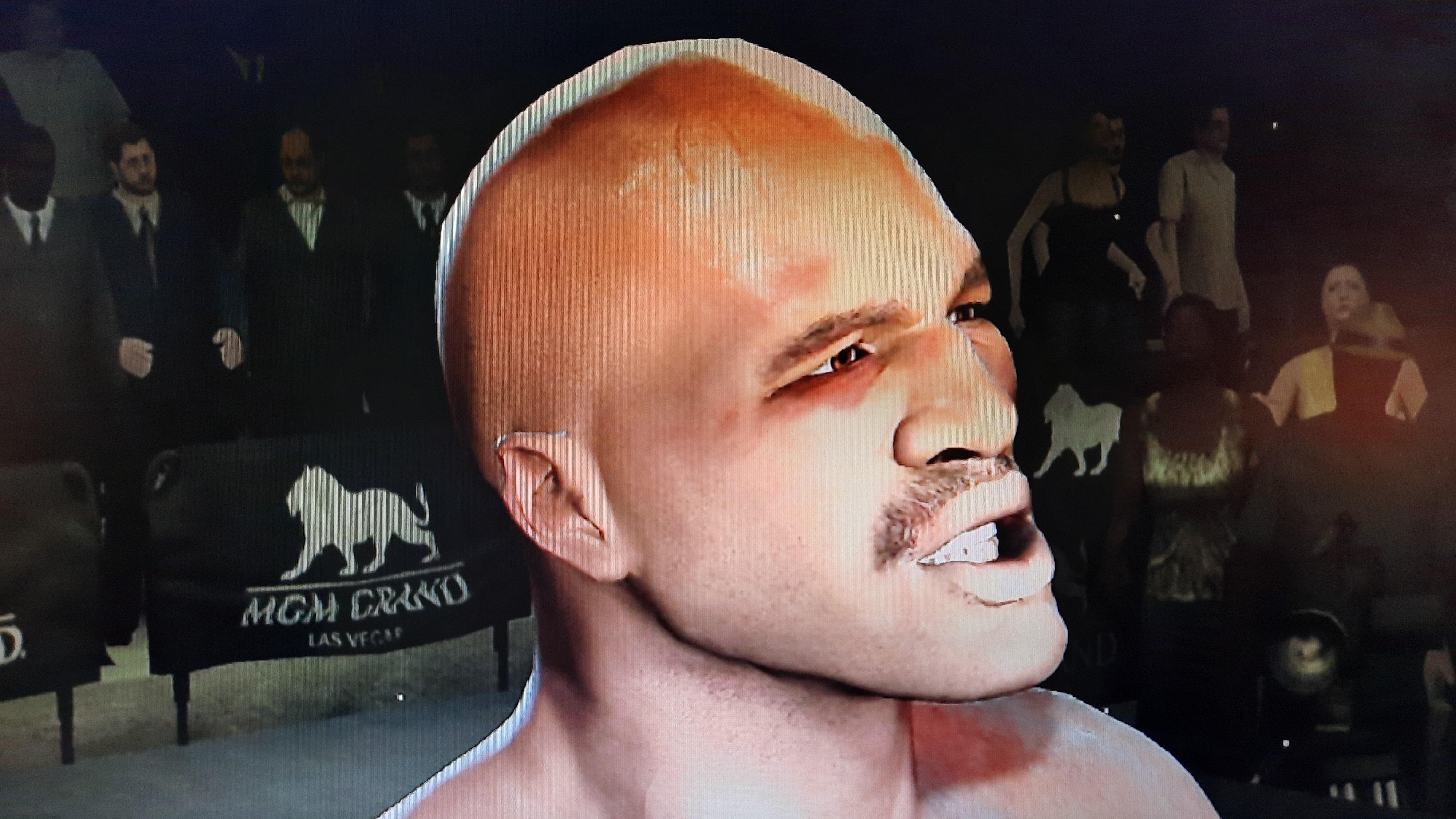 holyfield ear before and after 0009