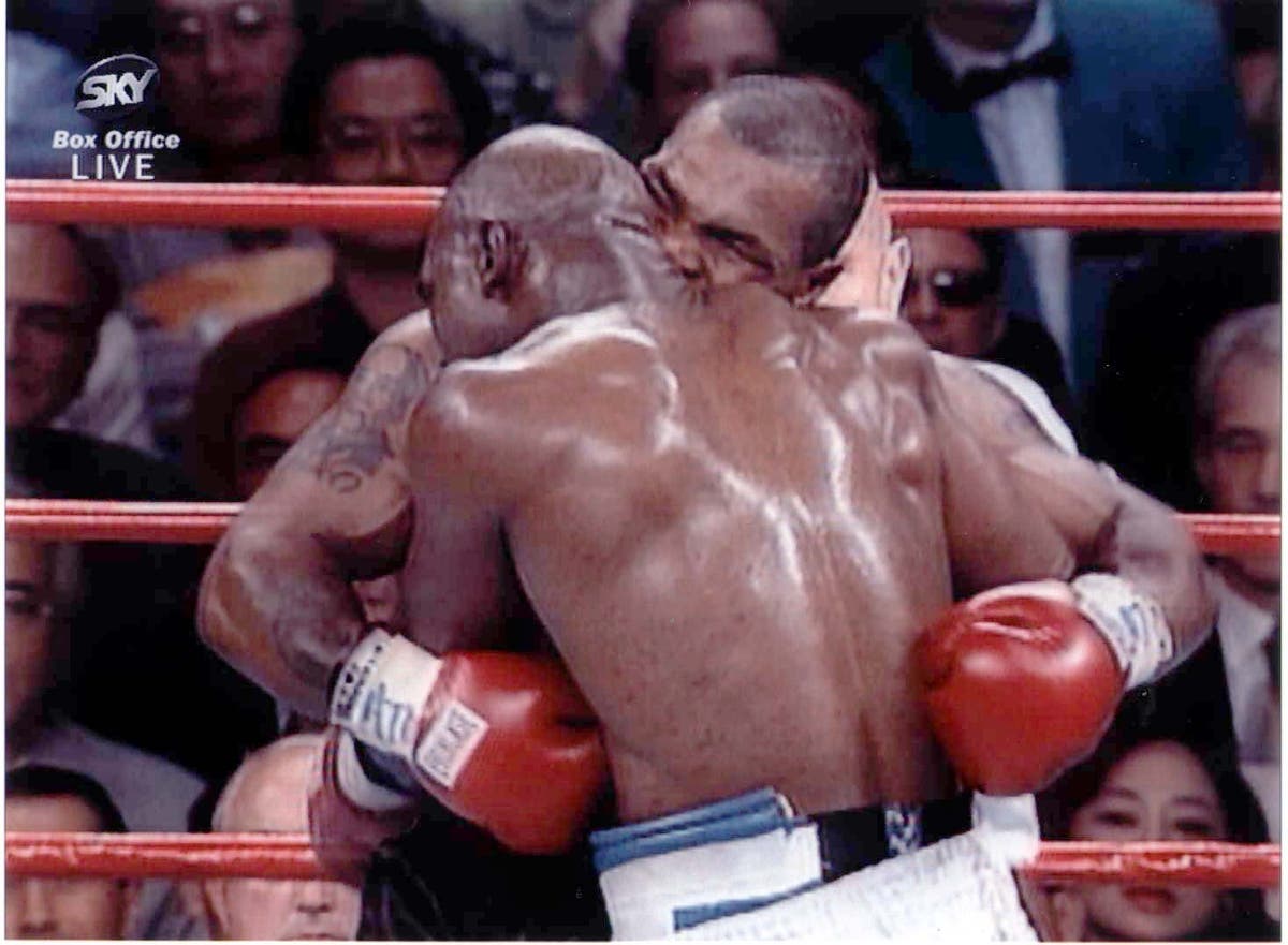 holyfield ear before and after 0023