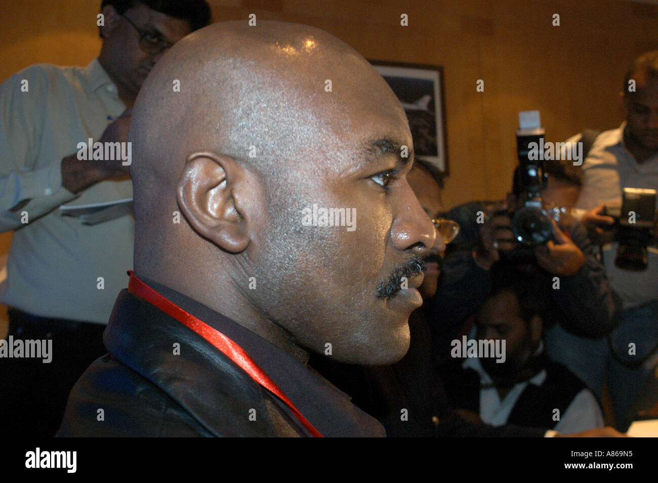 holyfield ear before and after 0025