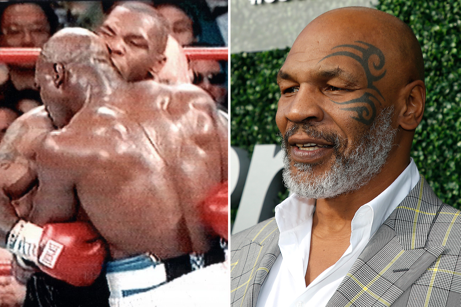 holyfield ear before and after 0029