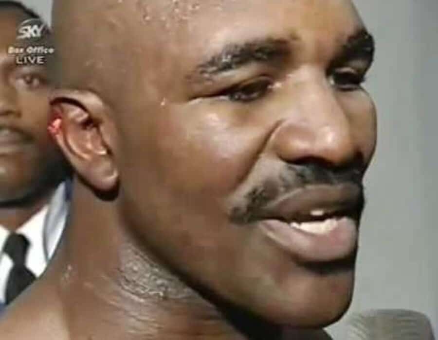 holyfield ear before and after 0035