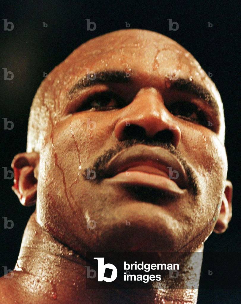 holyfield ear before and after 0039