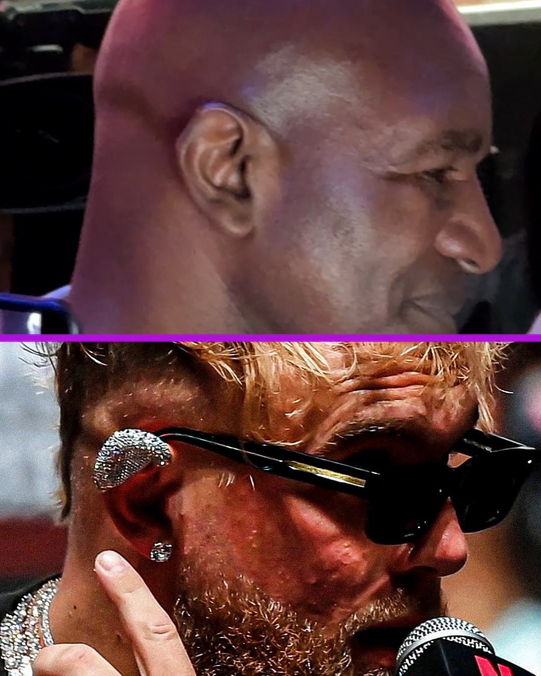 holyfield ear before and after 0048