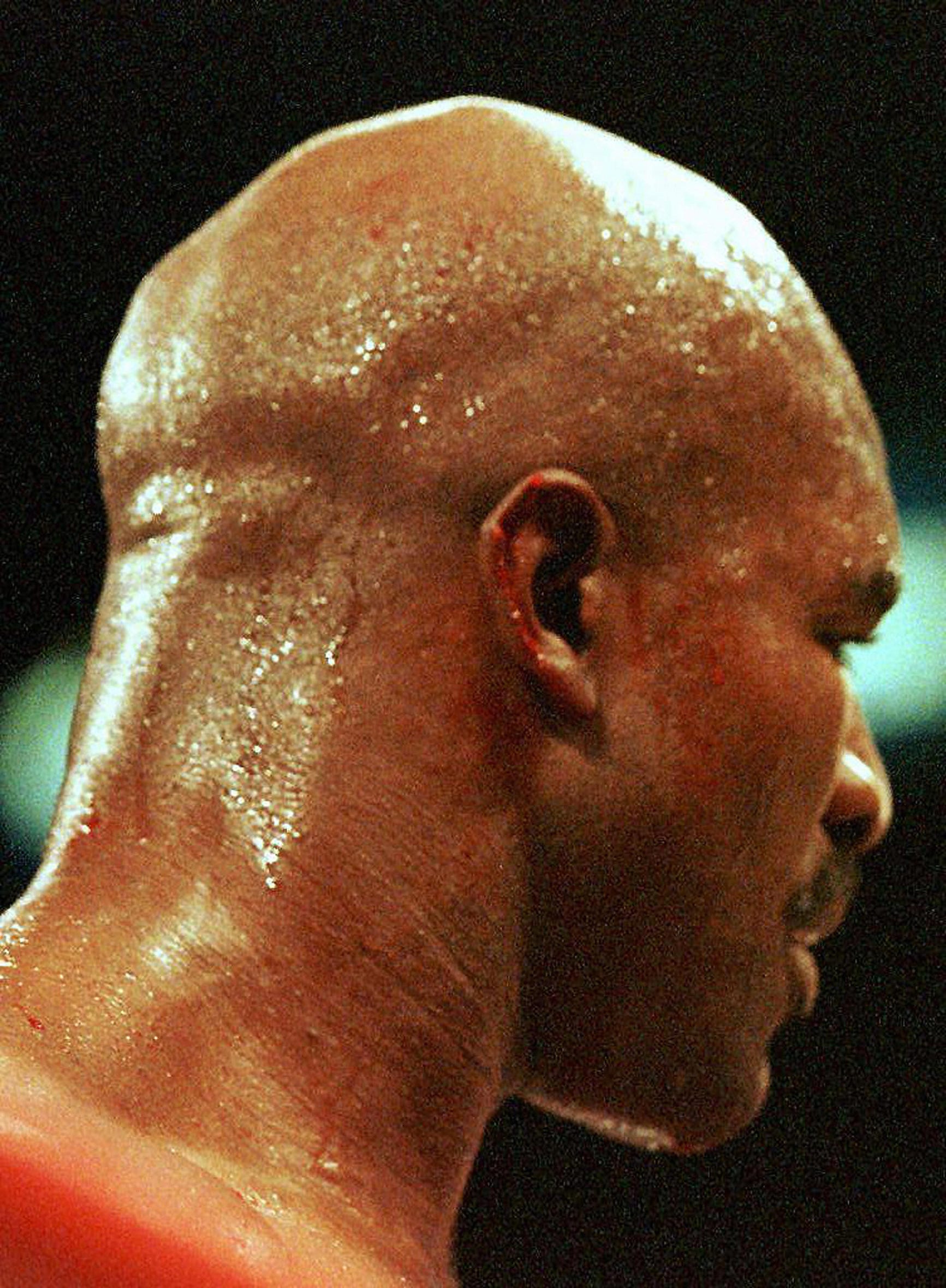 holyfield's ear after bite 0009