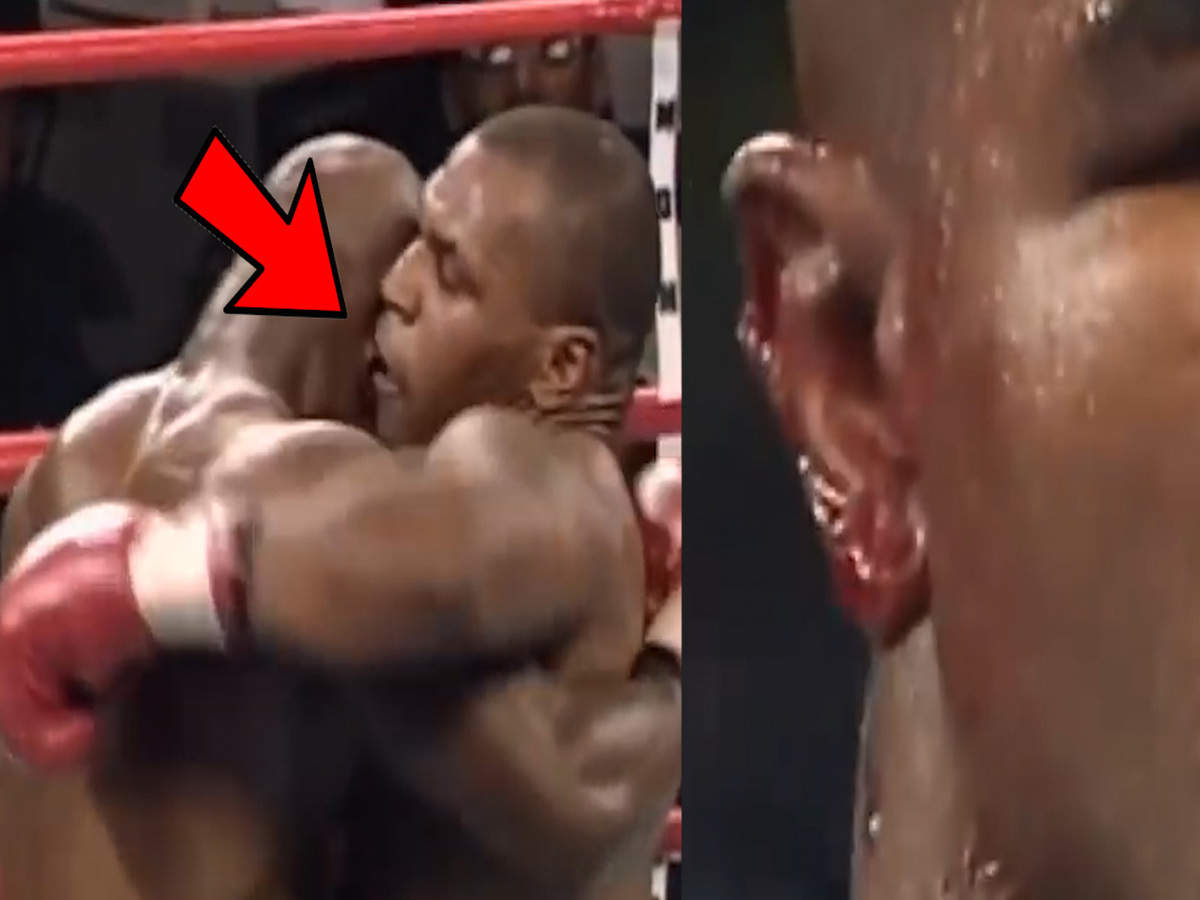 holyfield's ear after bite 0012