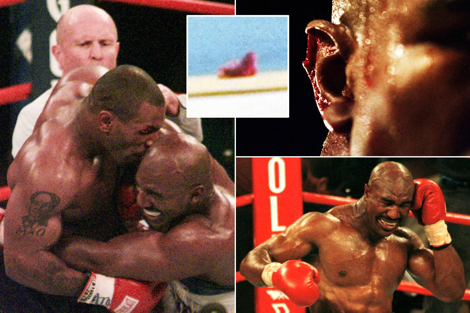 holyfield's ear after bite 0026