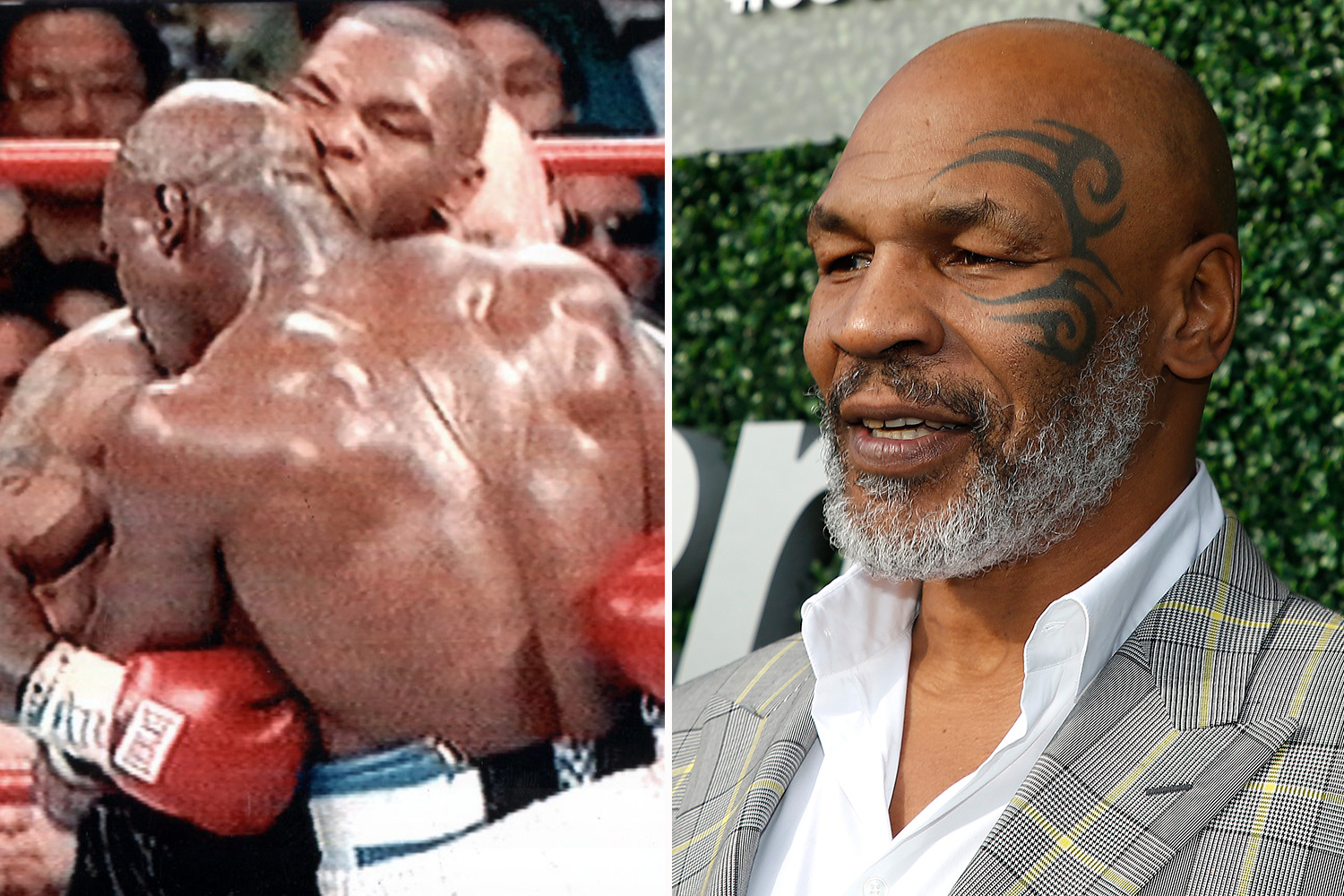 holyfield's ear after bite 0032