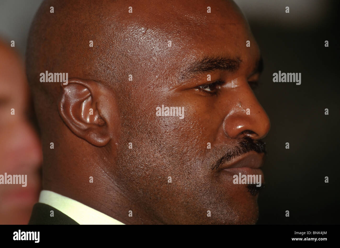 holyfield's ear after bite 0039