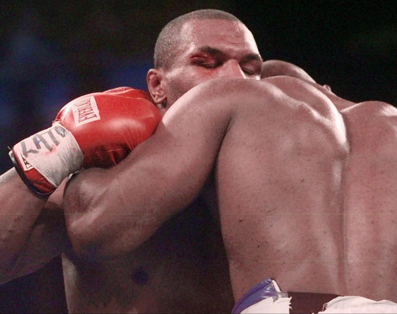 holyfield's ear after bite 0044