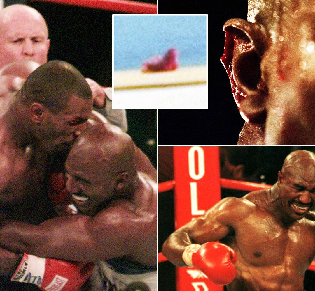 holyfield's ear after bite 0048