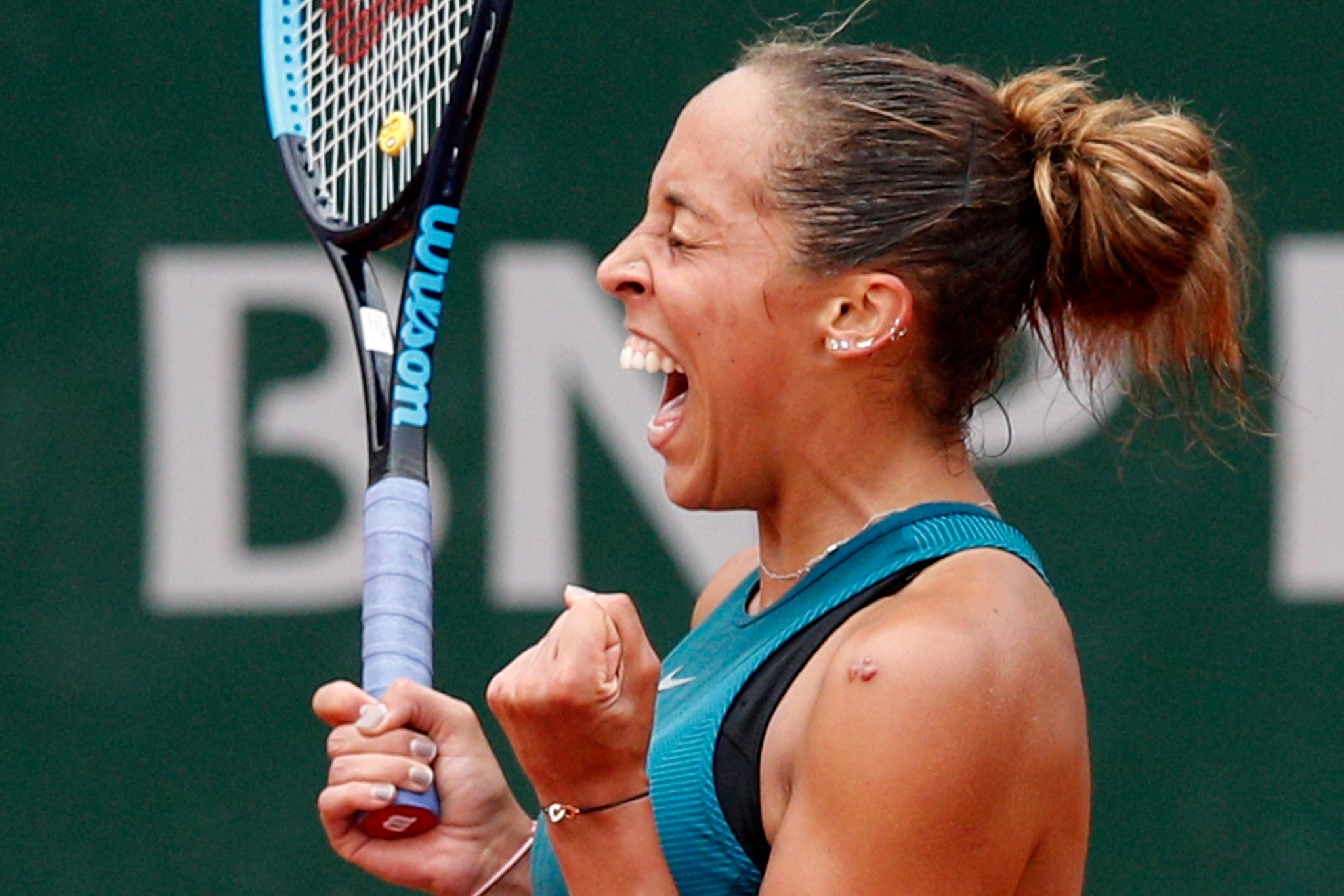 Madison Keys French Open injuries