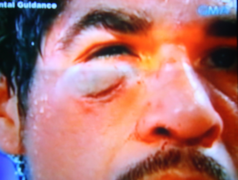 margarito vs pacquiao face 0034