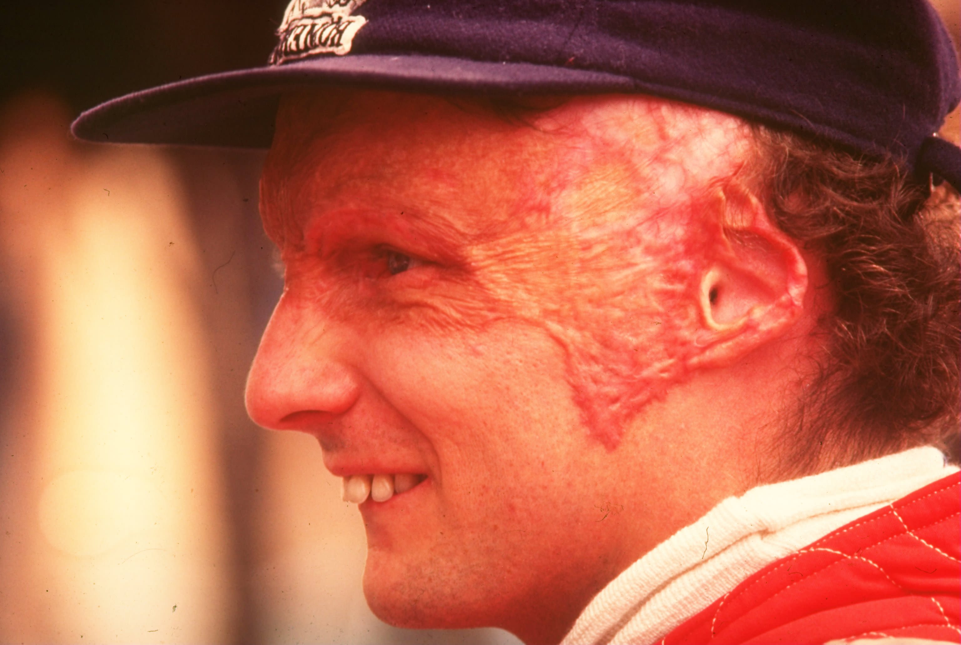 niki lauda photos 0032
