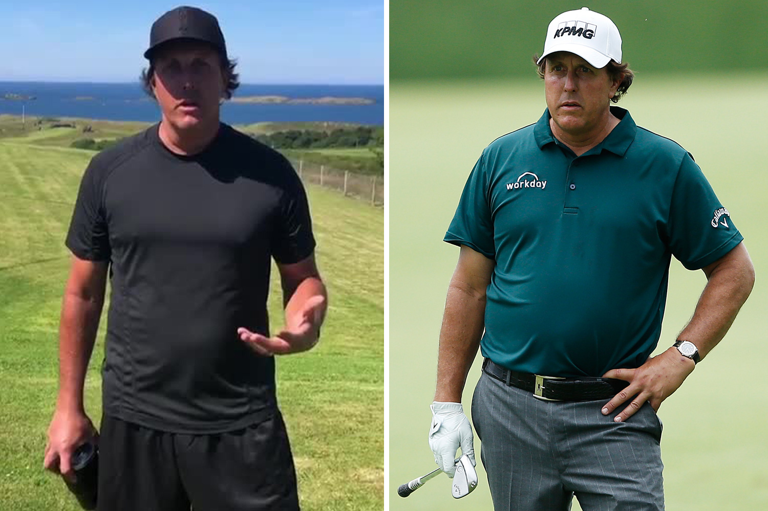 Phil Mickelson before and after photos