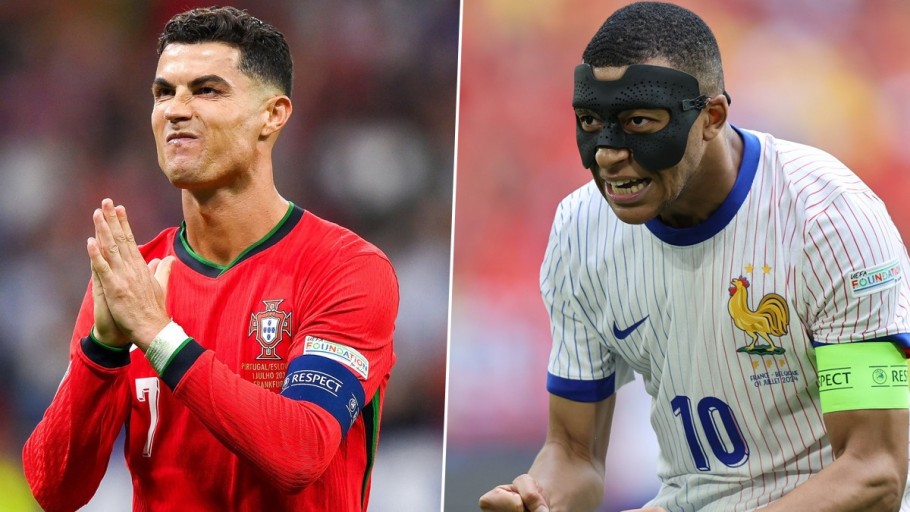 Ronaldo facial features.