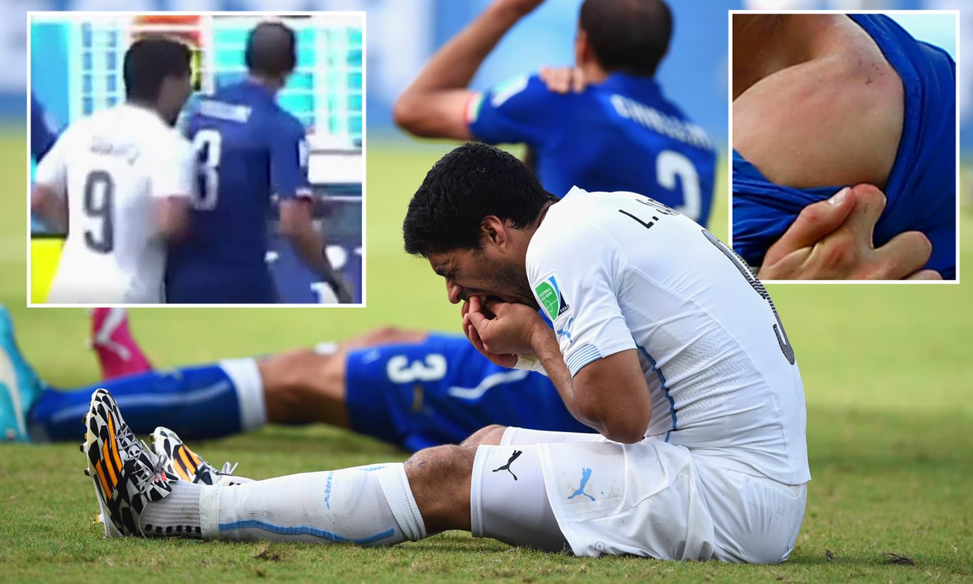 suarez bites chiellini 0011