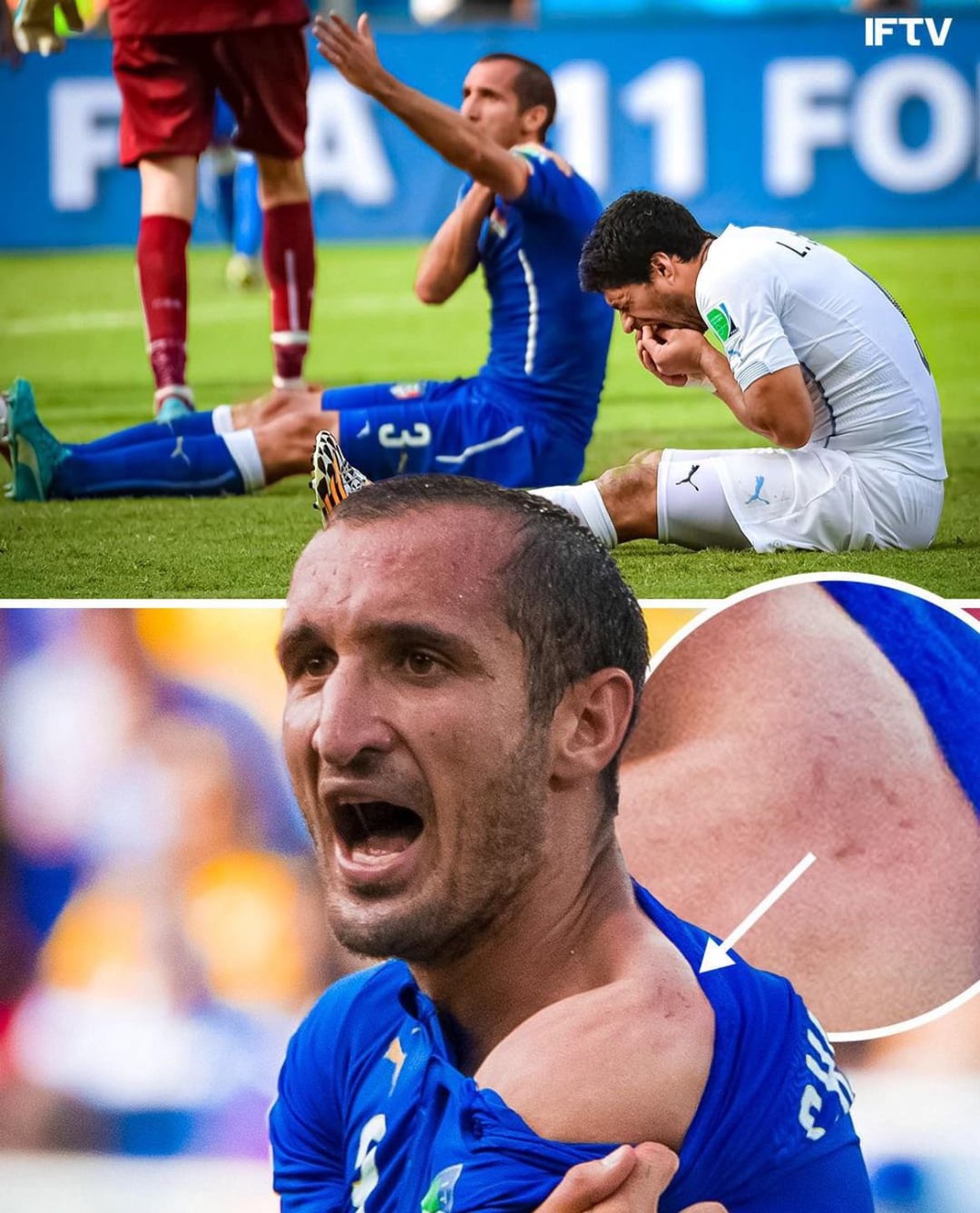 suarez bites chiellini 0020