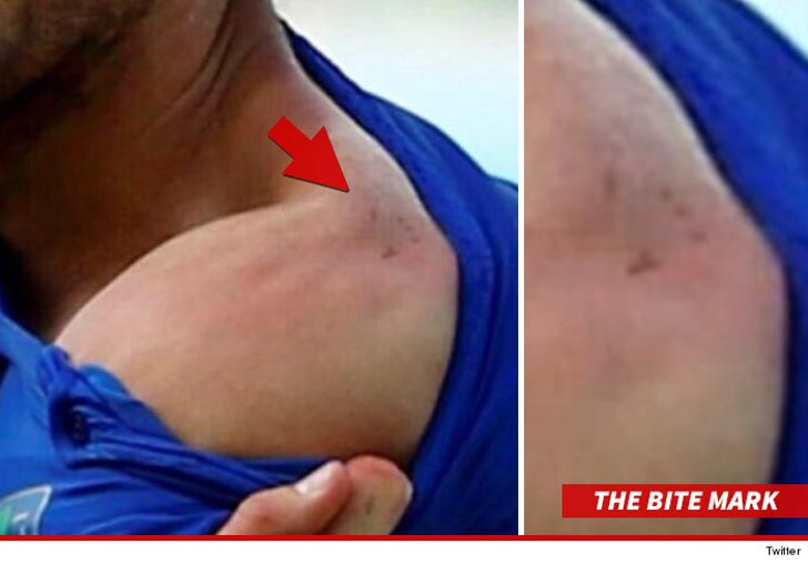 suarez bites chiellini 0031