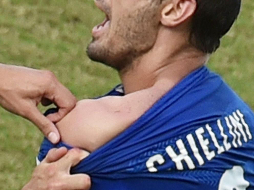 suarez bites chiellini 0041
