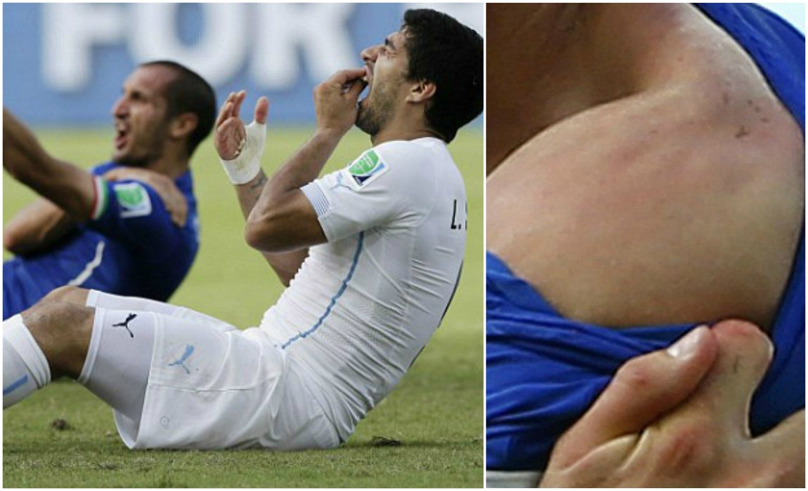 suarez bites chiellini 0043
