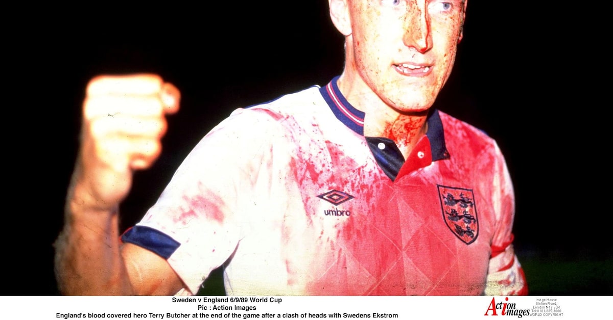 terry butcher blood 0009