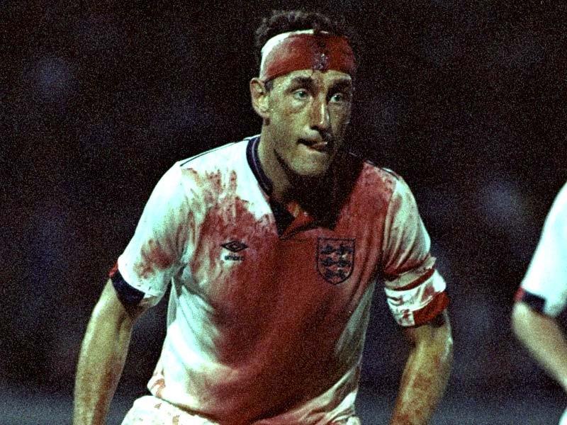 terry butcher blood 0013