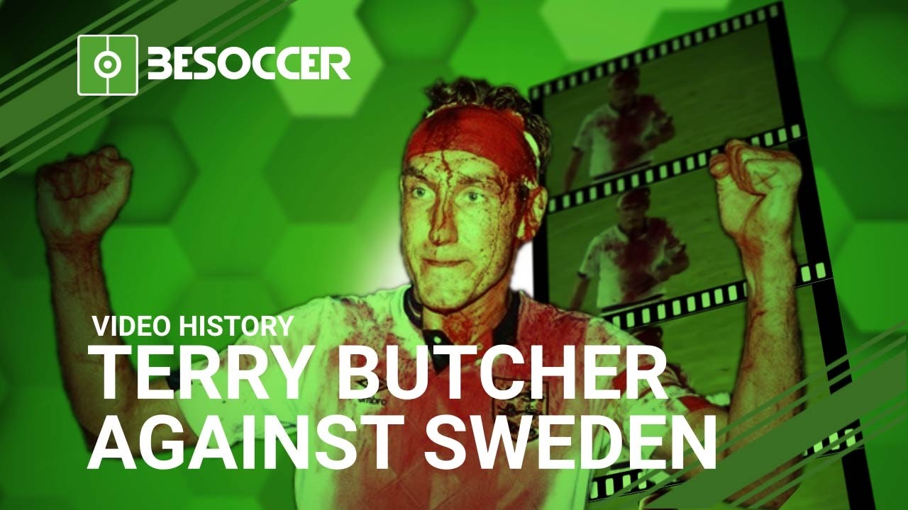 terry butcher blood 0028