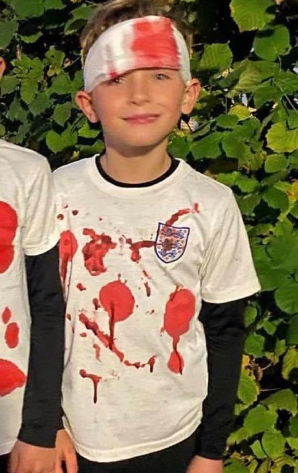 terry butcher blood 0040