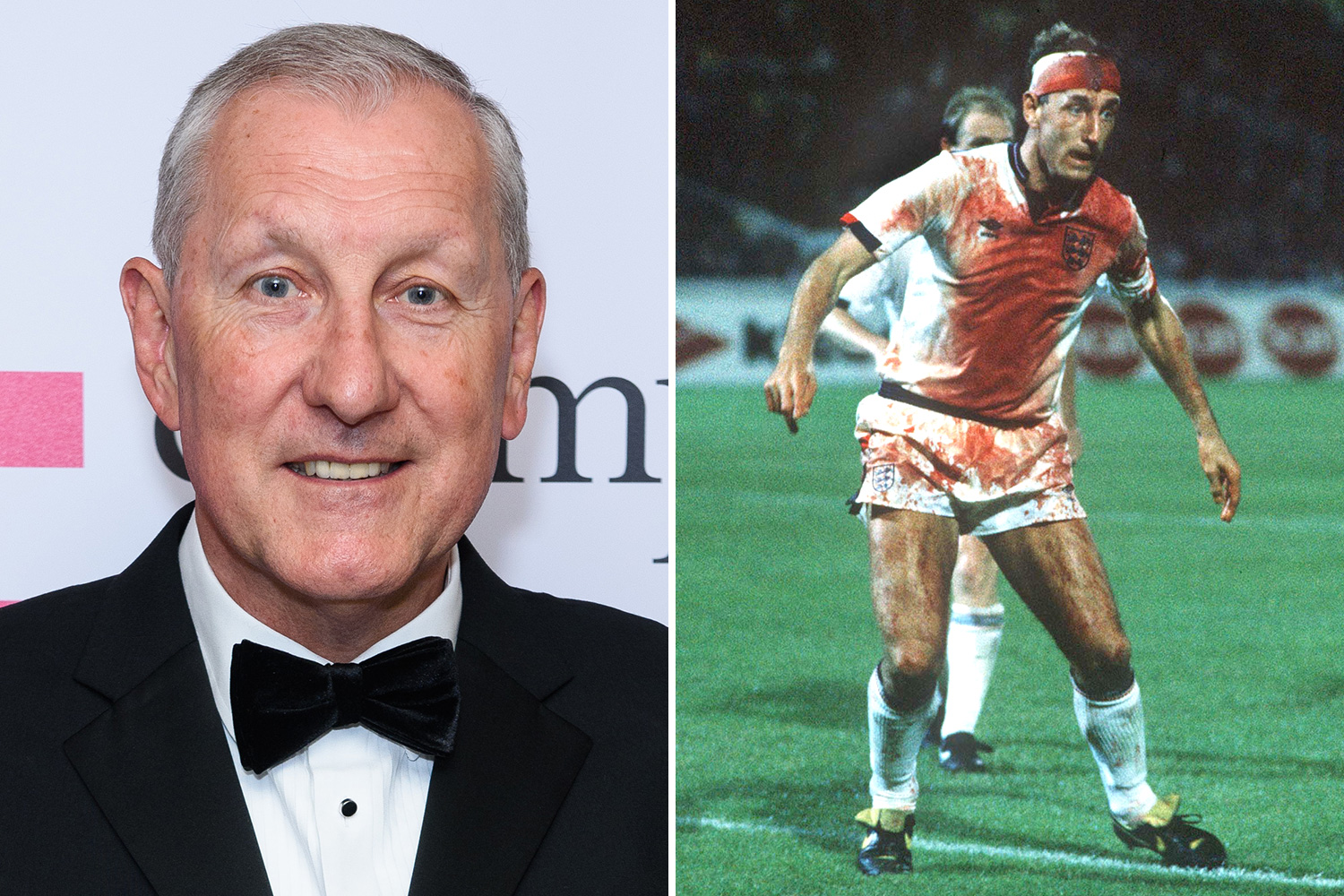 Terry Butcher injuries