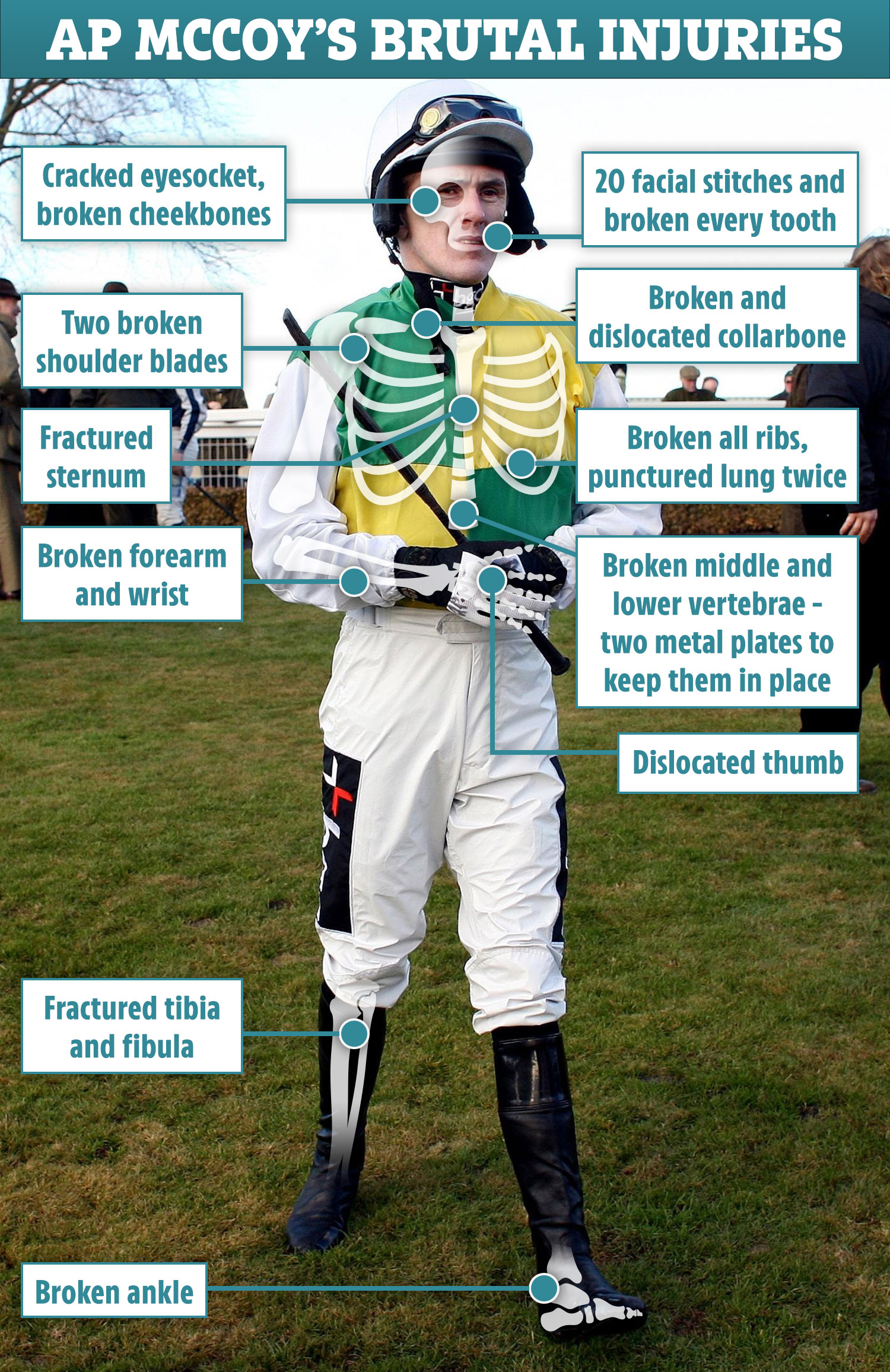 tony mccoy 0034