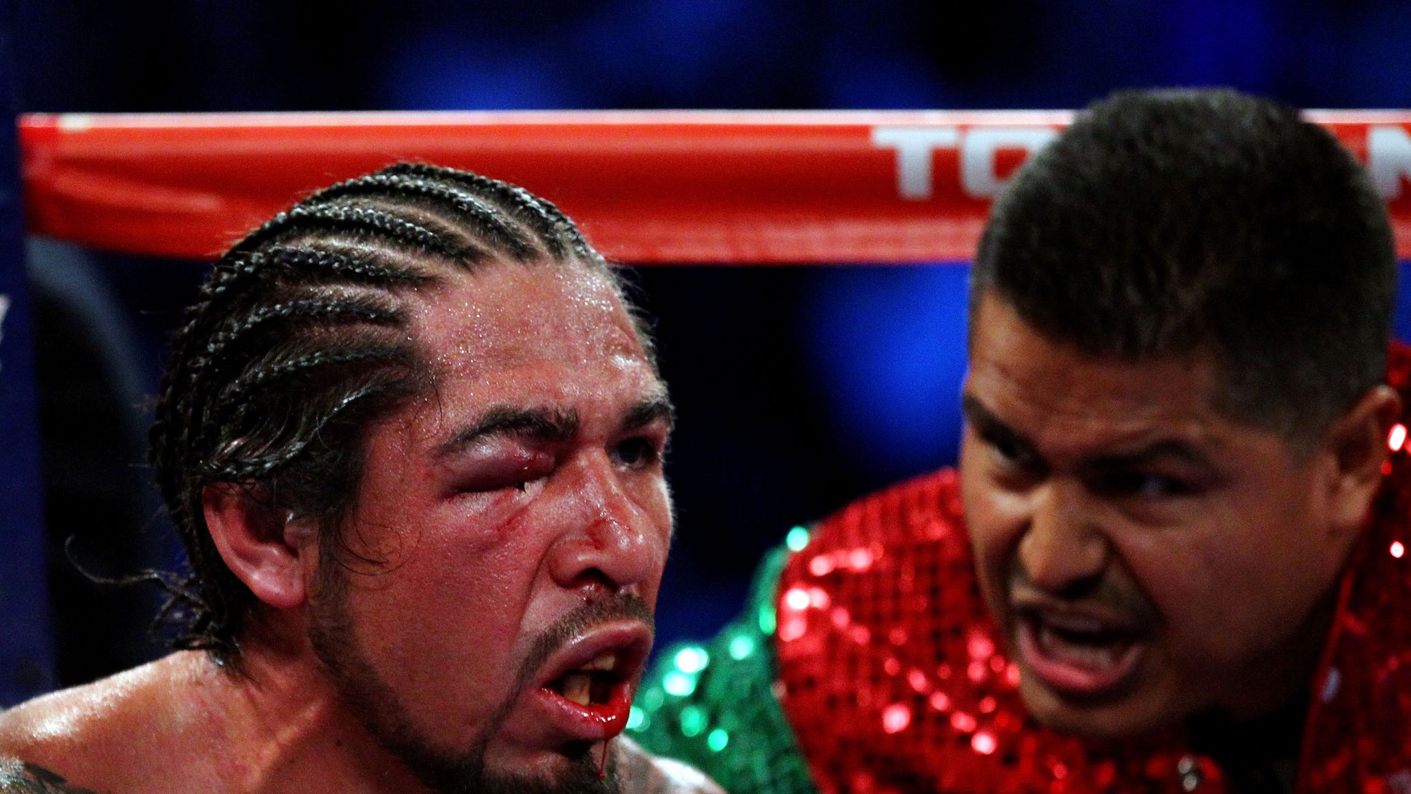 Sleek insights into antonio margarito’s eye injury and its impact