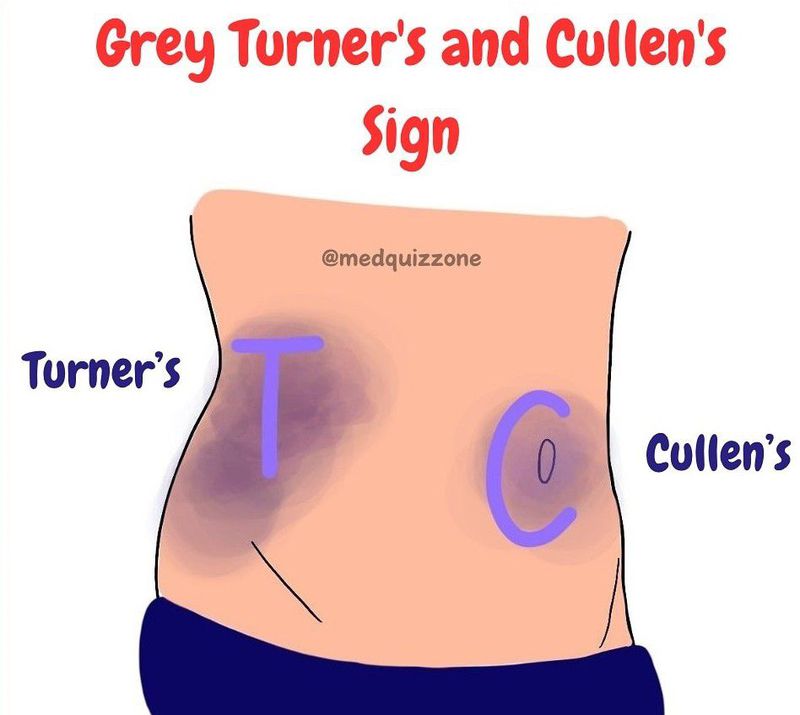 High-performance cullen sign photos capturing crucial medical insights