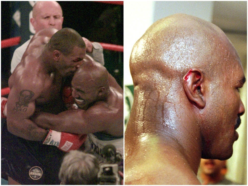 Electrifying moments captured as mike tyson bit a famous ear photo